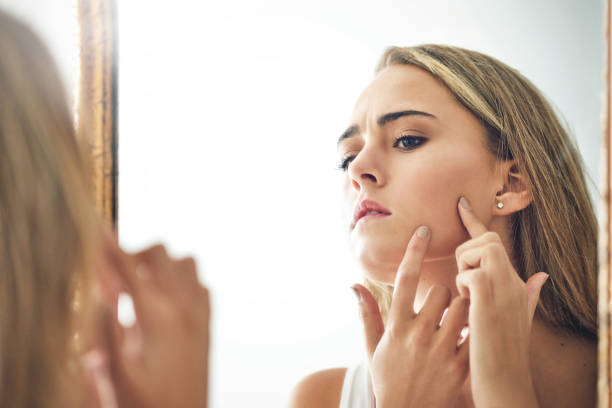Acne e Inositolo: Proprietà, Benefici per la Pelle e Consigli